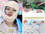 Bà bầu - 9X Nghệ An mang tam thai hiếm 8 nghìn ca có một, đẻ xong phải điều trị "méo miệng"