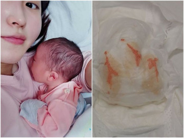 Thay tã cho con sơ sinh, mẹ hoảng hồn khi phát hiện bên trong có máu, vội vàng nhập viện