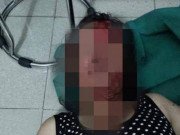 Tin tức - Hải Dương: Công an làm rõ vụ vợ tố bị chồng dí điện, dìm xuống ao