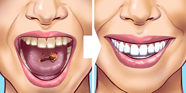 Răng bị ố vàng cứ áp dụng những cách này sẽ trắng sáng nhanh chóng - 10