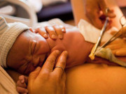 Làm mẹ - Con chào đời khóc lớn sau cắt dây rốn, mẹ lo lắng, bác sĩ vỗ tay chúc mừng