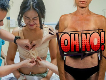 Những pha nâng ngực không thành làm các nàng thêm chùn bước