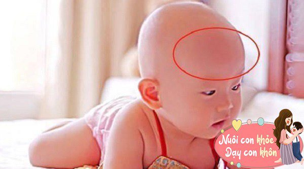 Những đứa trẻ có vầng trán cao đầy đặn thì khả năng tư duy logic, trí nhớ và chỉ số IQ của trẻ cũng cao hơn.