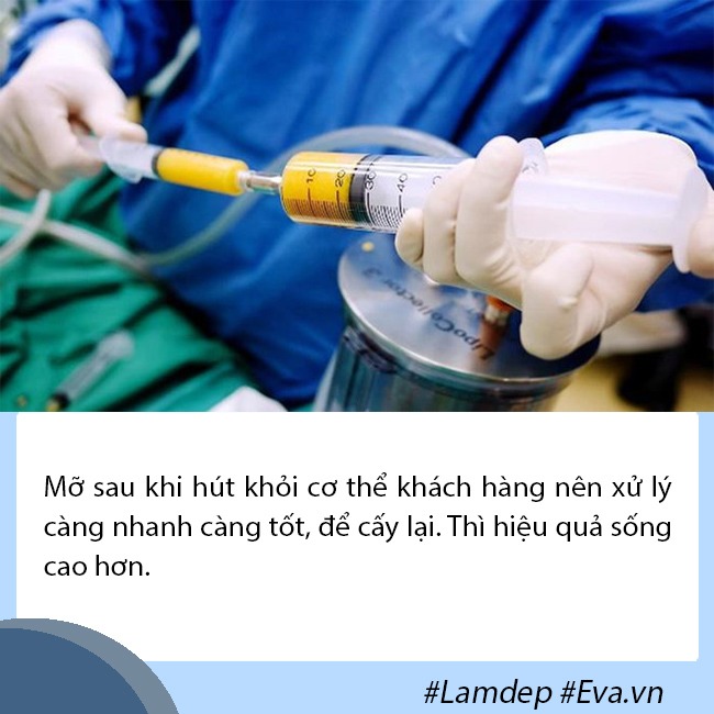 Cấy mỡ tự thân: Lấy mỡ vùng nào giữ lâu nhất, filler liệu có cửa? - 5