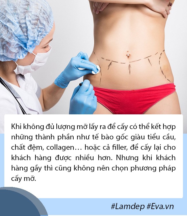 Cấy mỡ tự thân: Lấy mỡ vùng nào giữ lâu nhất, filler liệu có cửa? - 6