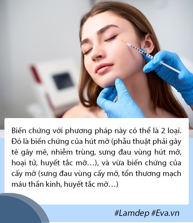 Cấy mỡ tự thân: Lấy mỡ vùng nào giữ lâu nhất, filler liệu có cửa? - 7