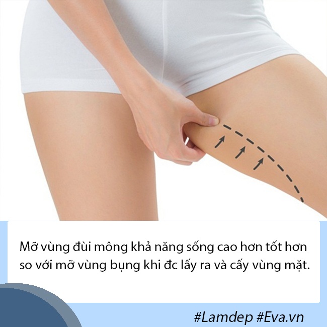 Cấy mỡ tự thân: Lấy mỡ vùng nào giữ lâu nhất, filler liệu có cửa? - 4