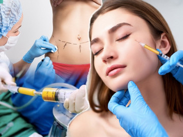 Cấy mỡ tự thân: Lấy mỡ vùng nào giữ lâu nhất, filler liệu có cửa?