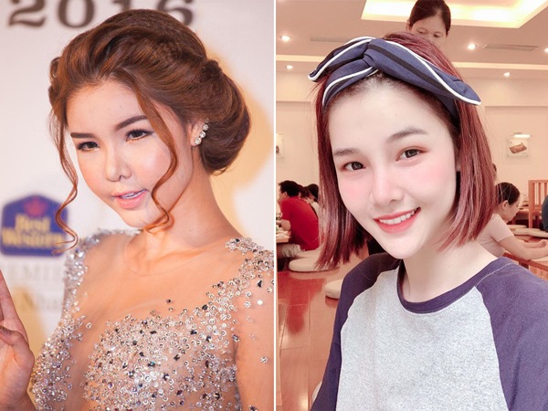 Kỳ Hân cũng chối bay nghi vấn thẩm mỹ và nàng siêu mẫu châu Á giải thích là cô bị dị ứng vì uống nhiều thuốc quá. Tuy nhiên những hình ảnh sau khi cô công khai thẩm mỹ đã làm dân tình chắc chắn hơn về nghi vấn trước đó.