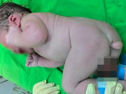 Bà bầu - Mẹ định bỏ thai vì con mọc đuôi, bác sĩ can ngăn, 7 năm sau nhận quà không ngờ