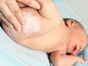 Kem chống hăm cho trẻ sơ sinh và cách dùng hiệu quả