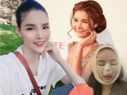 Làm đẹp - Bà xã Mạc Hồng Quân từng gây choáng với gương mặt đầy di chứng thẩm mỹ