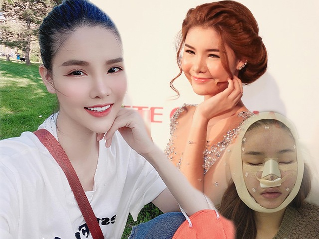 Bà xã Mạc Hồng Quân từng gây choáng với gương mặt đầy di chứng thẩm mỹ