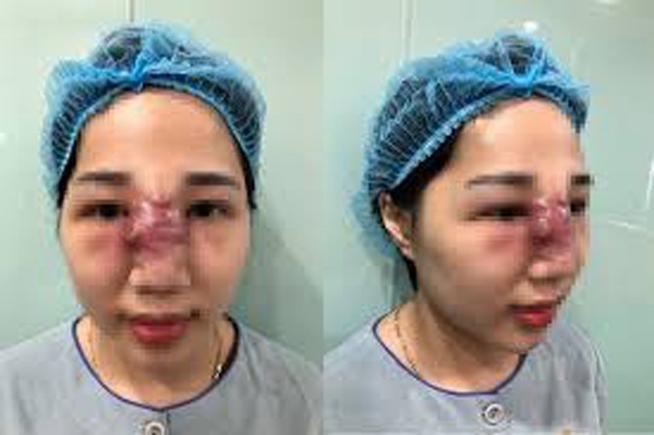 Cơ sở phẫu thuật thẩm mỹ không uy tín, quy trình thưc hiện cũng như hậu phẫu không không được đảm bảo là những yếu tố gây ra các vấn đề không mong muốn sau thẩm mỹ.