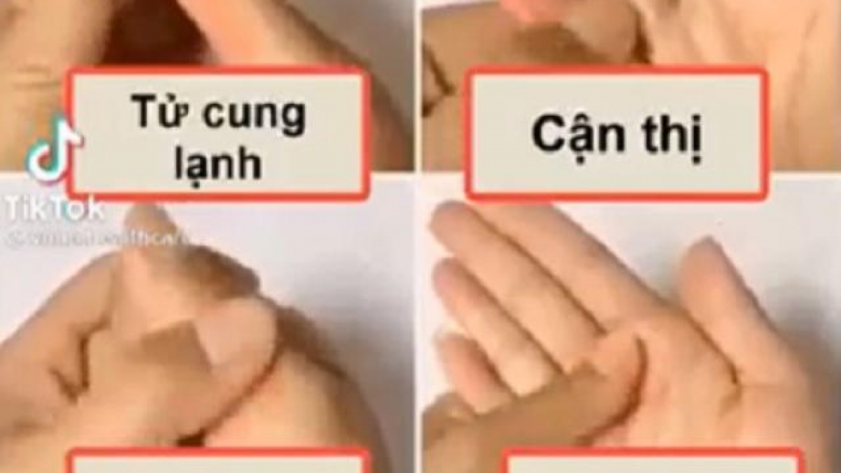 Bấm huyệt chữa tử cung lạnh: Phương pháp hiệu quả cho sức khỏe phụ nữ