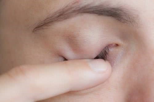 Massage mắt không thể chữa được khỏi cận thị.