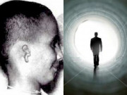 Tin tức - Con trai sinh ra với dị tật tai, bố mẹ sốc khi con kể nguyên nhân qua đời "kiếp trước"