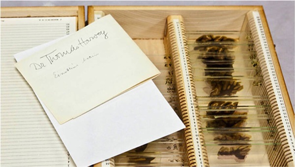 Các phần bộ não bị đánh cắp của Albert Einstein và chữ ký của bác sĩ Thomas Harvey tại Bảo tàng Mütter.