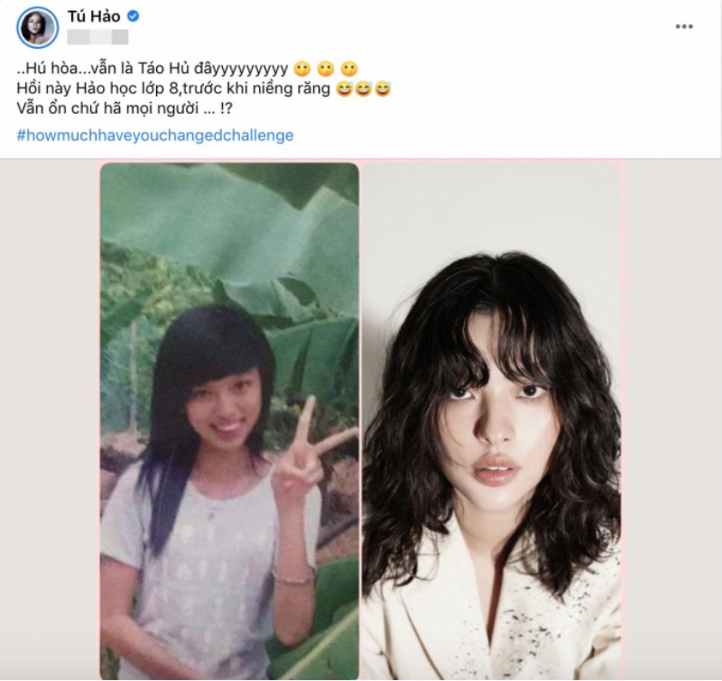 Chân dài đắt giá của làng mẫu Look Book Tú Hảo khoe ảnh năm xưa siêu ngố tàu. Cô dí dỏm, ảnh đại diện lúc đó là năm học lớp 8, răng vẫn chưa niềng nên cô nàng còn hơi hô. Giờ cô đã là gương mặt đình đám của làng mẫu Việt với đường nét sắc lẹm, thần thái cuốn hút rất high-fashion.