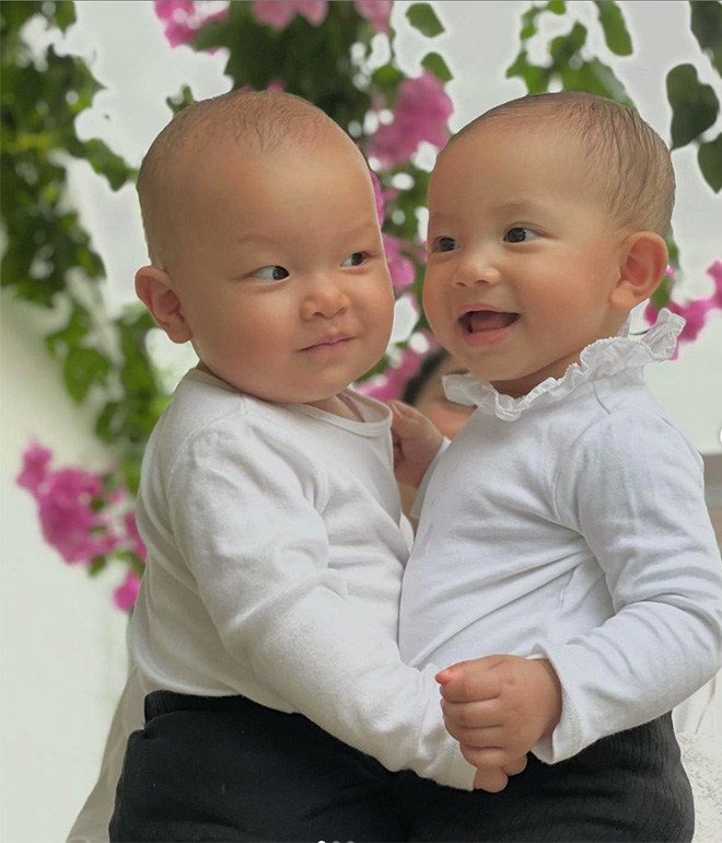 4 con sao Việt chào đời náo loạn bệnh viện, bác sĩ cũng thót tim, giờ xinh xắn bụ bẫm - 4