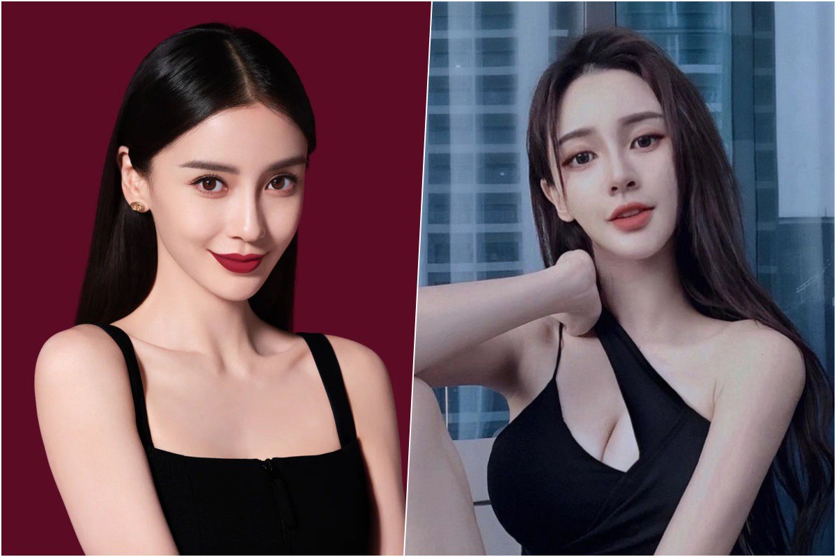 Những bản sao nhan sắc của Angelababy: Người đẹp tự nhiên, người chi 19 tỷ amp;#34;đập mặtamp;#34; - 6