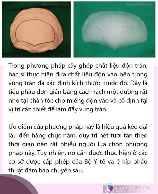 Đi độn trán, chưa thấy vầng trán thanh lịch đâu, cô nàng nhận về cái kết sưng như ong chích - 6