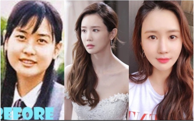 Lee Da Hae bị chê dao kéo, mỗi năm 1 gương mặt.