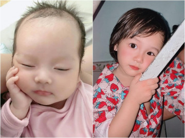 Uống thuốc tránh thai vẫn dính, 9X sinh con đầu hói mắt hí, 2 năm sau ai cũng khen