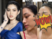 Làm đẹp - Đỗ Thị Hà "đu trend" dùng Acid lên mặt, da bong tróc nhưng kết quả sau 1 tháng mới phục