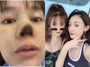 Ngôi sao 24/7: Sau 1 năm mũi hoại tử, diện mạo mỹ nhân dao kéo khiến khán giả giật mình