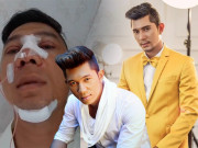 Làm đẹp - Cùng bạn gái Ngân 98 PTTM, gương mặt nam nhạc sĩ này có được như mong đợi?