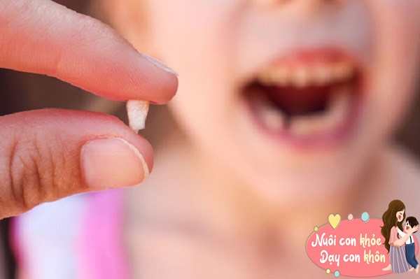 Đừng vứt răng sữa vì chúng có thể cứu trẻ trong tương lai, BS nói cách nhổ răng sữa chuẩn - 6
