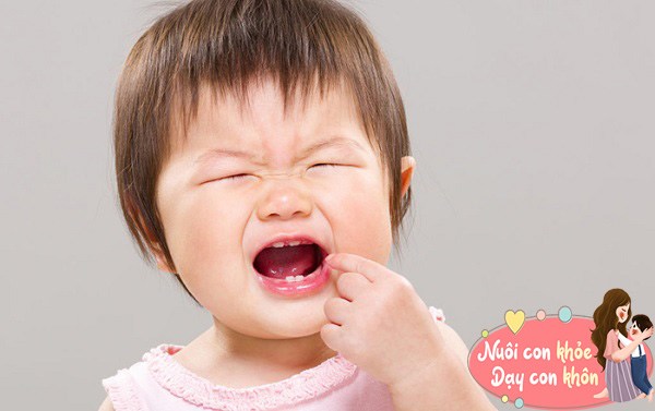 Đừng vứt răng sữa vì chúng có thể cứu trẻ trong tương lai, BS nói cách nhổ răng sữa chuẩn - 4