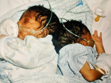 Vui mừng vì mang thai đôi, mẹ trẻ đau xót nhìn 2 đứa trẻ khi ra đời