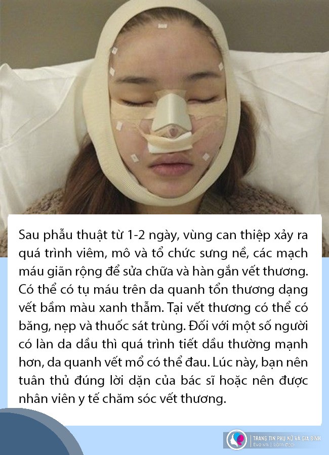 Phẫu thuật vùng mặt xong cần chăm sóc da và trang điểm thế nào để vừa xinh mà vẫn khoẻ? - 1