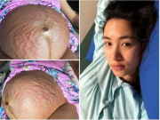 Bà bầu - Hòa Minzy dũng cảm đăng ảnh bụng bầu "rỉ máu", chồng đại gia nhắn câu "mát lòng mát dạ"