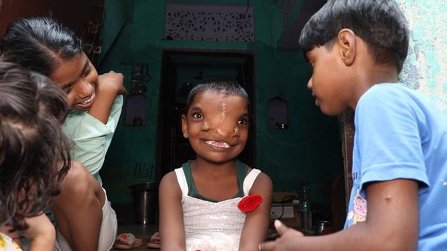 The little girl has 2 strange noses, is worshiped as a god by the villagers, and constantly comes to ask for blessings - 4