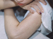 Sức khỏe - Tại sao có phụ nữ nhiều lông trên cơ thể nhưng người khác lại thưa thớt, cái nào tốt hơn?
