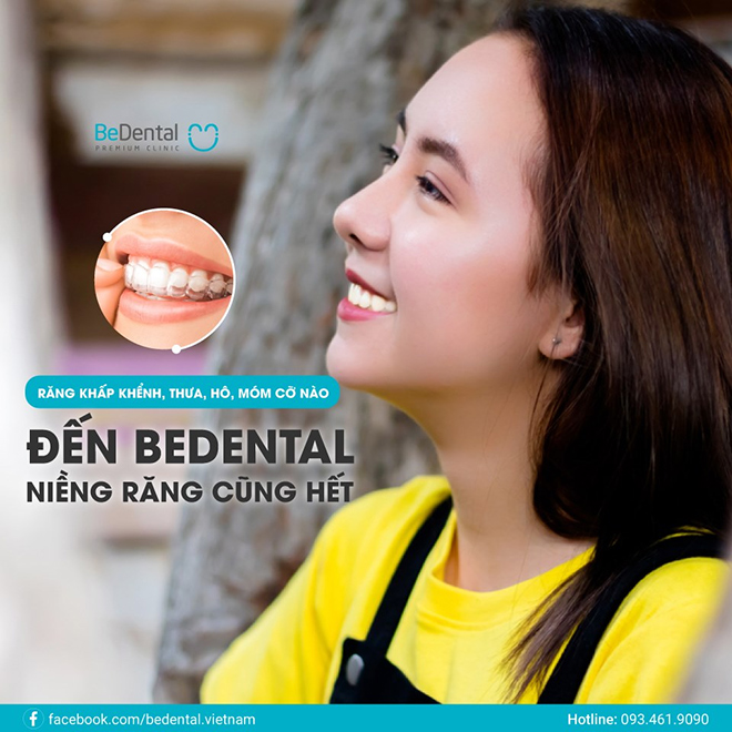 Nha khoa Thẩm mỹ Bedental - Địa chỉ niềng răng trả góp uy tín thủ tục đơn giản - 1