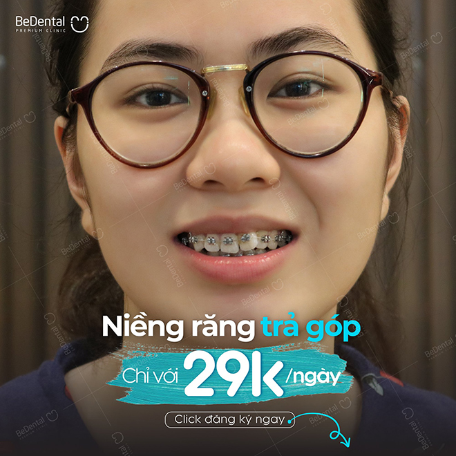 Nha khoa Thẩm mỹ Bedental - Địa chỉ niềng răng trả góp uy tín thủ tục đơn giản - 4