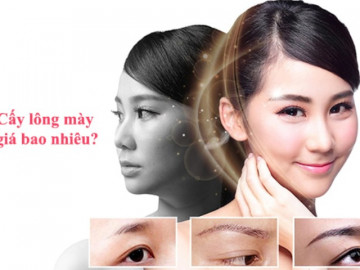Cấy lông mày - phương pháp làm đẹp không đau phái đẹp yêu thích nhất