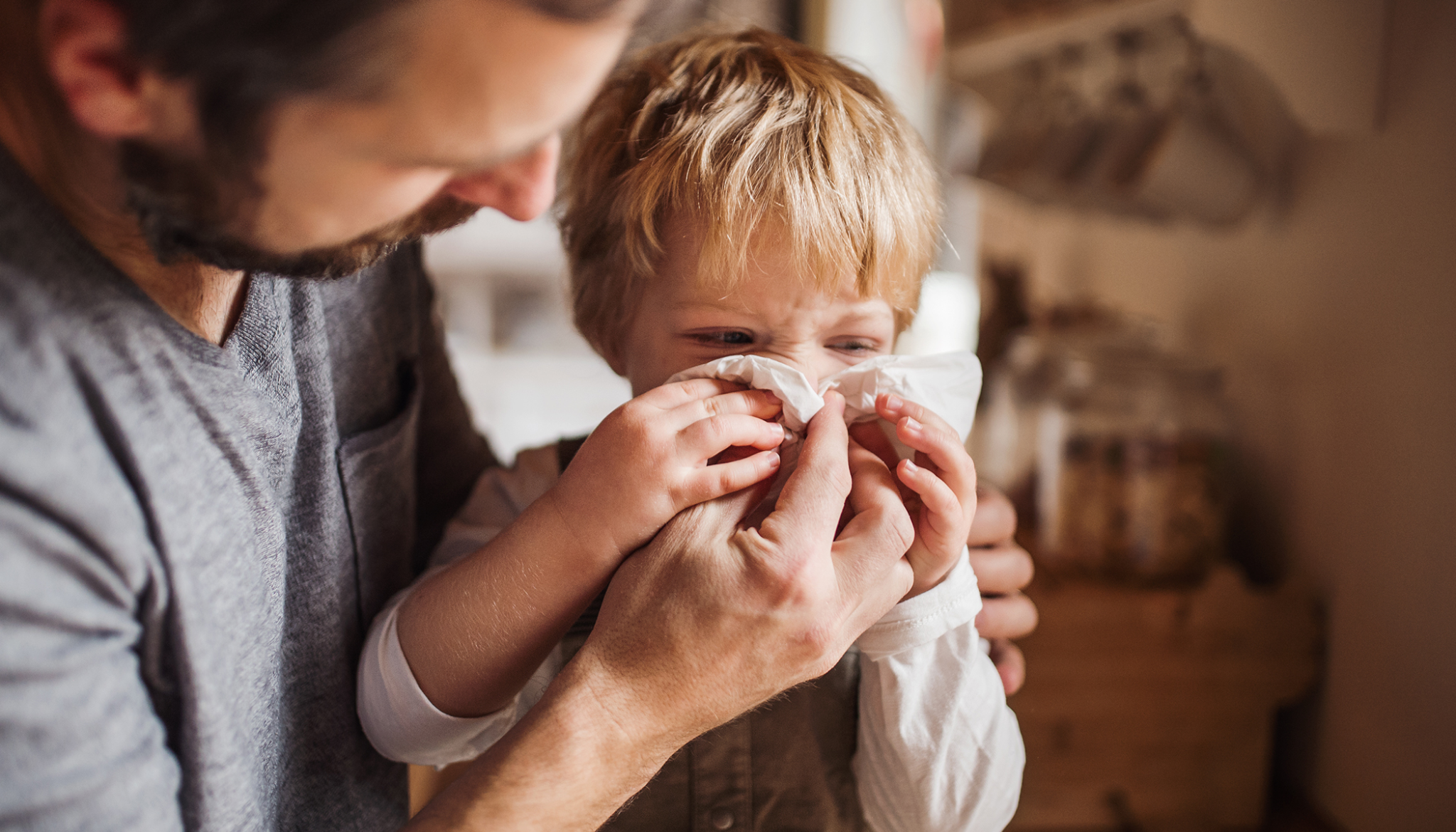 Cúm A ở trẻ em thường dễ bị nhầm lẫn với các triệu chứng cảm lạnh. (Ảnh minh họa)
