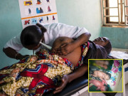 Bà bầu - Bà mẹ 30 tuổi đã có 12 con, mang thai tư vẫn tự đẻ tại nhà