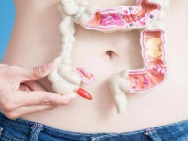 3 nguyên nhân hàng đầu gây ung thư đại trực tràng