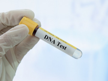 Lấy tóc của con trai xét nghiệm ADN, người đàn ông sốc nặng khi phát hiện con trở thành em họ