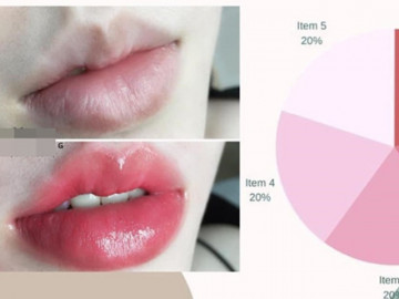 Cấy môi sinh học là gì? Chuyên gia nói gì về phương pháp cấy hồng môi khử thâm