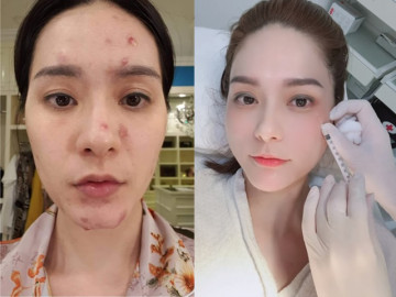 Ở nhà 400 tỷ, nữ đại gia Quận 7 cũng không chối từ bộ môn làm đẹp tiêm chích rẻ bèo