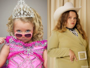 Giải trí - Hoa hậu nhí từng nhận cát-xê cao, sau 4 năm làm fan thất vọng, giờ phẫu thuật còn 1 nửa