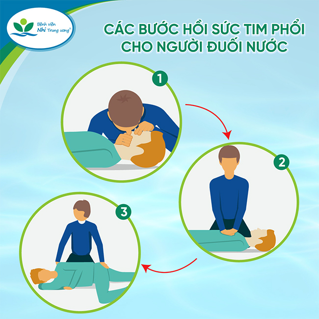 Các bước hồi sức tim phổi cho người đuối nước