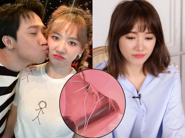 Hari Won đăng ảnh thấy sức khỏe kém sau khi Trấn Thành làm rõ chuyện rạn nứt